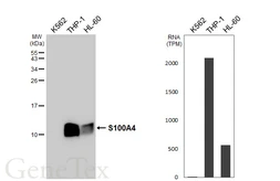 Anti-S100A4 antibody [HL6258] used in Western Blot (WB). GTX648350
