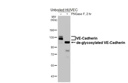 Anti-VE-Cadherin antibody [HL6263] used in Western Blot (WB). GTX648355