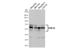 Anti-PHF10 antibody [HL6286] used in Western Blot (WB). GTX648388