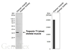 Anti-Troponin T1 (slow) skeletal muscle antibody [HL6319] used in Western Blot (WB). GTX648429