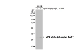 Anti-eIF2 alpha (phospho Ser51) antibody [HL6327] used in Western Blot (WB). GTX648437