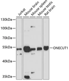 Anti-HNF6 antibody used in Western Blot (WB). GTX64885