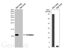 Anti-S100A4 antibody [HL6435] used in Western Blot (WB). GTX648880