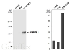 Anti-MAN2A1 antibody [HL6456] used in Western Blot (WB). GTX648904