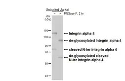 Anti-Integrin alpha 4 antibody [HL6500] used in Western Blot (WB). GTX648956