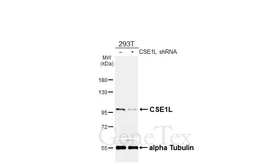 Anti-CSE1L antibody [HL6555] used in Western Blot (WB). GTX649025