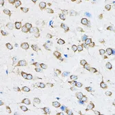 Anti-RPL23 antibody used in IHC (Paraffin sections) (IHC-P). GTX64903