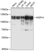 Anti-NOP14 antibody used in Western Blot (WB). GTX64909