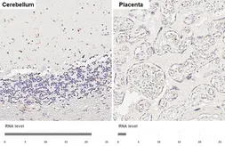 Anti-CX3CR1 antibody [HL6609] used in IHC (Paraffin sections) (IHC-P). GTX649309