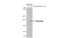 Anti-Tankyrase antibody [HL6612] used in Western Blot (WB). GTX649312