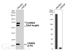 Anti-CARD8 antibody [HL6656] used in Western Blot (WB). GTX649365