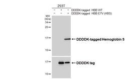 Anti-Hemoglobin S antibody [HL6668] used in Western Blot (WB). GTX649377