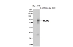 Anti-MDM2 antibody [HL6717] used in Western Blot (WB). GTX649428