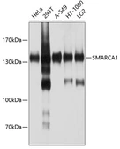 Anti-SMARCA1 antibody used in Western Blot (WB). GTX64945