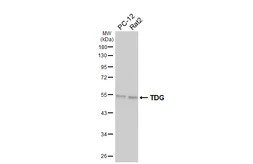 Anti-TDG antibody [HL6733] used in Western Blot (WB). GTX649456