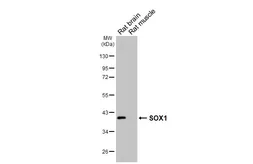 Anti-SOX1 antibody [HL6737] used in Western Blot (WB). GTX649460