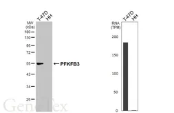 Anti-PFKFB3 antibody [HL6739] used in Western Blot (WB). GTX649462