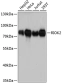 Anti-RIOK2 antibody used in Western Blot (WB). GTX64949