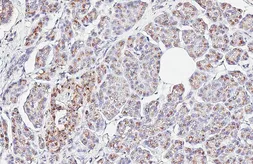 Anti-MAN2A1 antibody [HL6777] used in IHC (Paraffin sections) (IHC-P). GTX649508