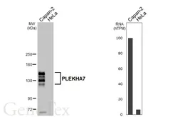 Anti-PLEKHA7 antibody [HL6807] used in Western Blot (WB). GTX649621