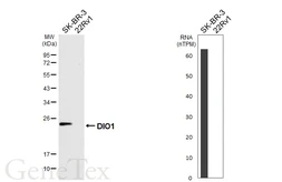 Anti-DIO1 antibody [HL6861] used in Western Blot (WB). GTX649705
