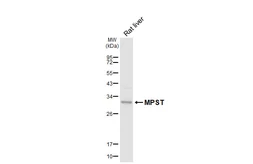 Anti-MPST antibody [HL6870] used in Western Blot (WB). GTX649714
