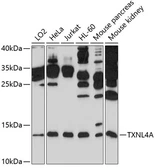 Anti-TXNL4A antibody used in Western Blot (WB). GTX64992