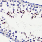 Anti-HFM1 antibody used in IHC (Paraffin sections) (IHC-P). GTX65542