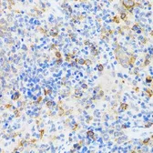 Anti-CHAF1B antibody used in IHC (Paraffin sections) (IHC-P). GTX65808