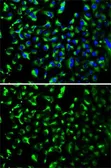 Anti-Prohibitin antibody used in Immunocytochemistry/ Immunofluorescence (ICC/IF). GTX65815