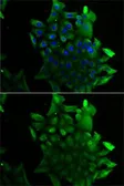 Anti-SLA/LP antibody used in Immunocytochemistry/ Immunofluorescence (ICC/IF). GTX65825