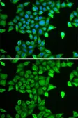 Anti-PSMA6 antibody used in Immunocytochemistry/ Immunofluorescence (ICC/IF). GTX65847