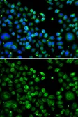 Anti-TXNDC5 antibody used in Immunocytochemistry/ Immunofluorescence (ICC/IF). GTX65848