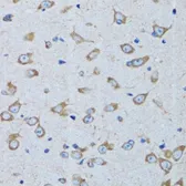 Anti-Arginyl tRNA synthetase antibody used in IHC (Paraffin sections) (IHC-P). GTX65850