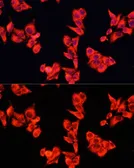 Anti-p190-B RhoGAP antibody used in Immunocytochemistry/ Immunofluorescence (ICC/IF). GTX65862