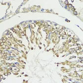 Anti-HACE1 antibody used in IHC (Paraffin sections) (IHC-P). GTX65876