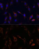 Anti-VPS25 antibody used in Immunocytochemistry/ Immunofluorescence (ICC/IF). GTX65881