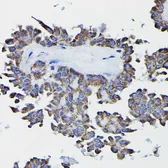 Anti-Glutathione S-transferase kappa 1 antibody used in IHC (Paraffin sections) (IHC-P). GTX65889