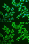 Anti-ALAS-E antibody used in Immunocytochemistry/ Immunofluorescence (ICC/IF). GTX65890