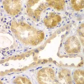 Anti-UBA6 antibody used in IHC (Paraffin sections) (IHC-P). GTX65920