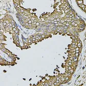 Anti-Fast skeletal myosin light chain 1 antibody used in IHC (Paraffin sections) (IHC-P). GTX65975