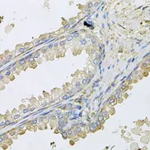 Anti-Cyclophilin C antibody used in IHC (Paraffin sections) (IHC-P). GTX65991