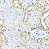 Anti-hCG beta 7 antibody used in IHC (Paraffin sections) (IHC-P). GTX66027