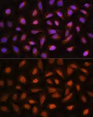 Anti-CtBP2 antibody used in Immunocytochemistry/ Immunofluorescence (ICC/IF). GTX66034
