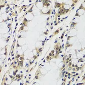 Anti-CASC5 antibody used in IHC (Paraffin sections) (IHC-P). GTX66163