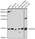 Anti-VAMP8 antibody used in Western Blot (WB). GTX66224