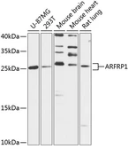 Anti-ARFRP1 antibody used in Western Blot (WB). GTX66247