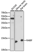 Anti-RABIF antibody used in Western Blot (WB). GTX66331