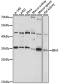 Anti-BIN3 antibody used in Western Blot (WB). GTX66384