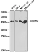 Anti-HEXIM2 antibody used in Western Blot (WB). GTX66400
